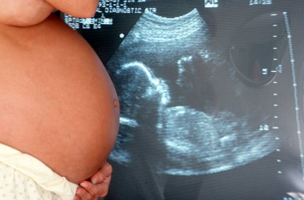04-06-07_schwangere-ultraschall.jpg - 23103 Bytes